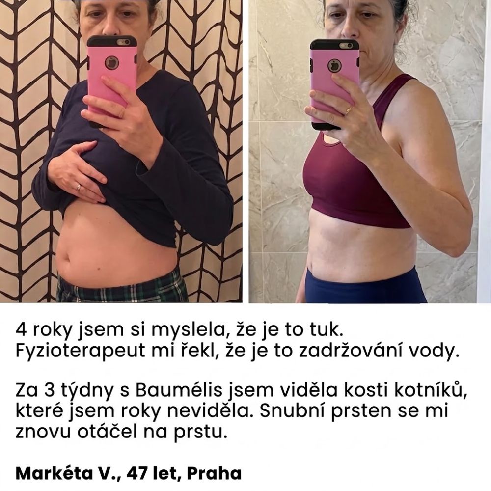 Menopauza zadržuje vodu. Baumélis ji přirozeně odvádí. — Cirkulační detoxikační bylinný čaj