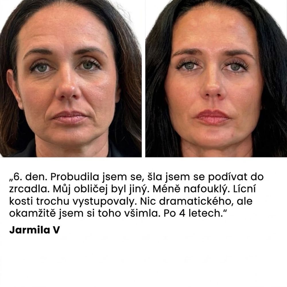 Menopauza zadržuje vodu. Baumélis ji přirozeně odvádí. — Cirkulační detoxikační bylinný čaj