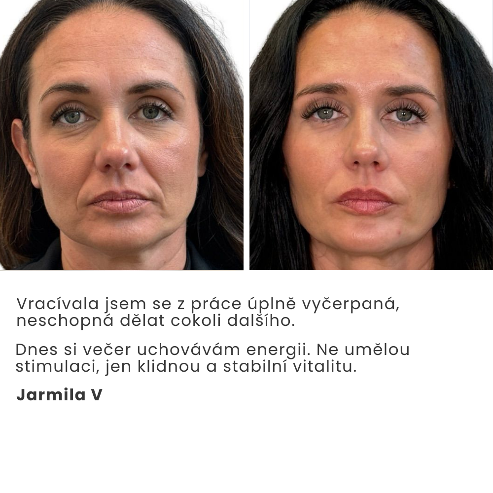 Cirkulační detoxikační bylinný čaj – Baumélis